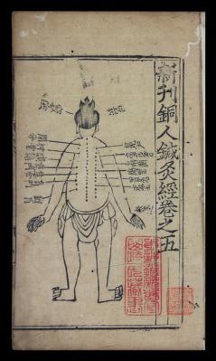 1271年至1368年，新刊铜人針灸经 : 七卷