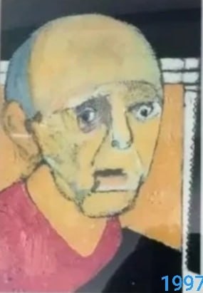 #艺术品 威廉·乌特莫伦(William Utermohlen，（1933-2007），出生德国，长居英国的美国具象艺术家，以其晚期自画像而闻名，这些自画像是在 1995 年诊断出可能患有阿尔茨海默病后完成的